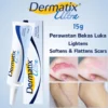 Dermatix Ultra China