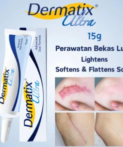 Dermatix Ultra China
