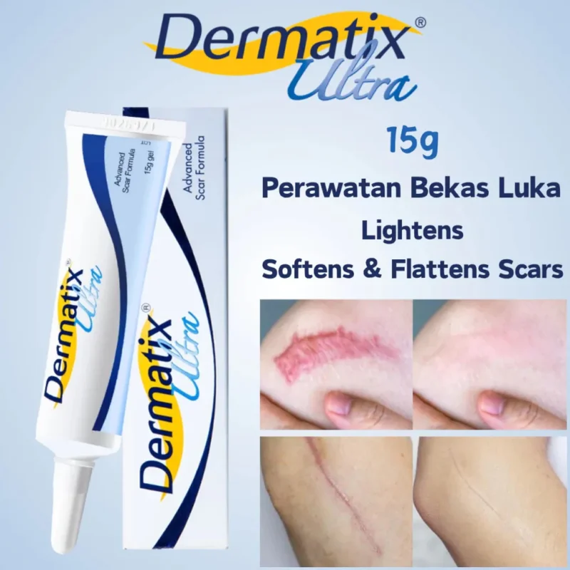 Dermatix Ultra China
